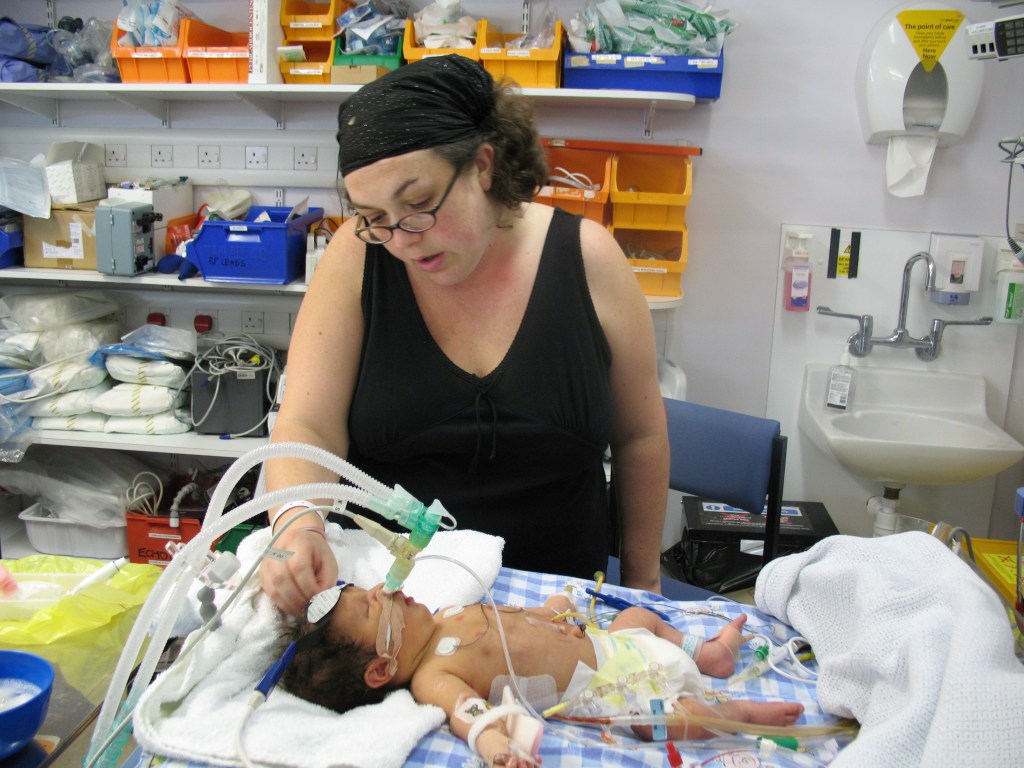 Living with babyloss