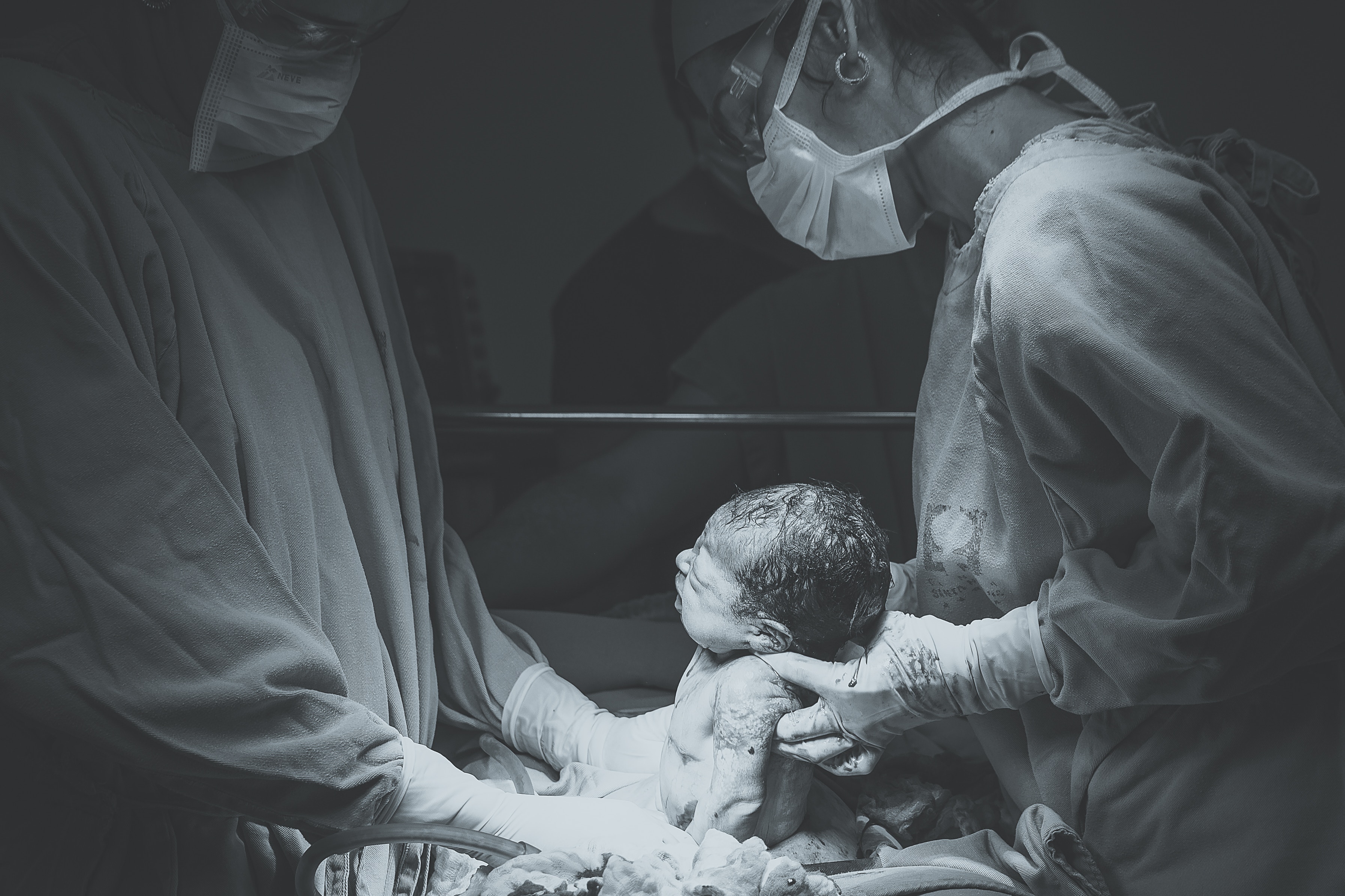 Preparing for a Caesarean