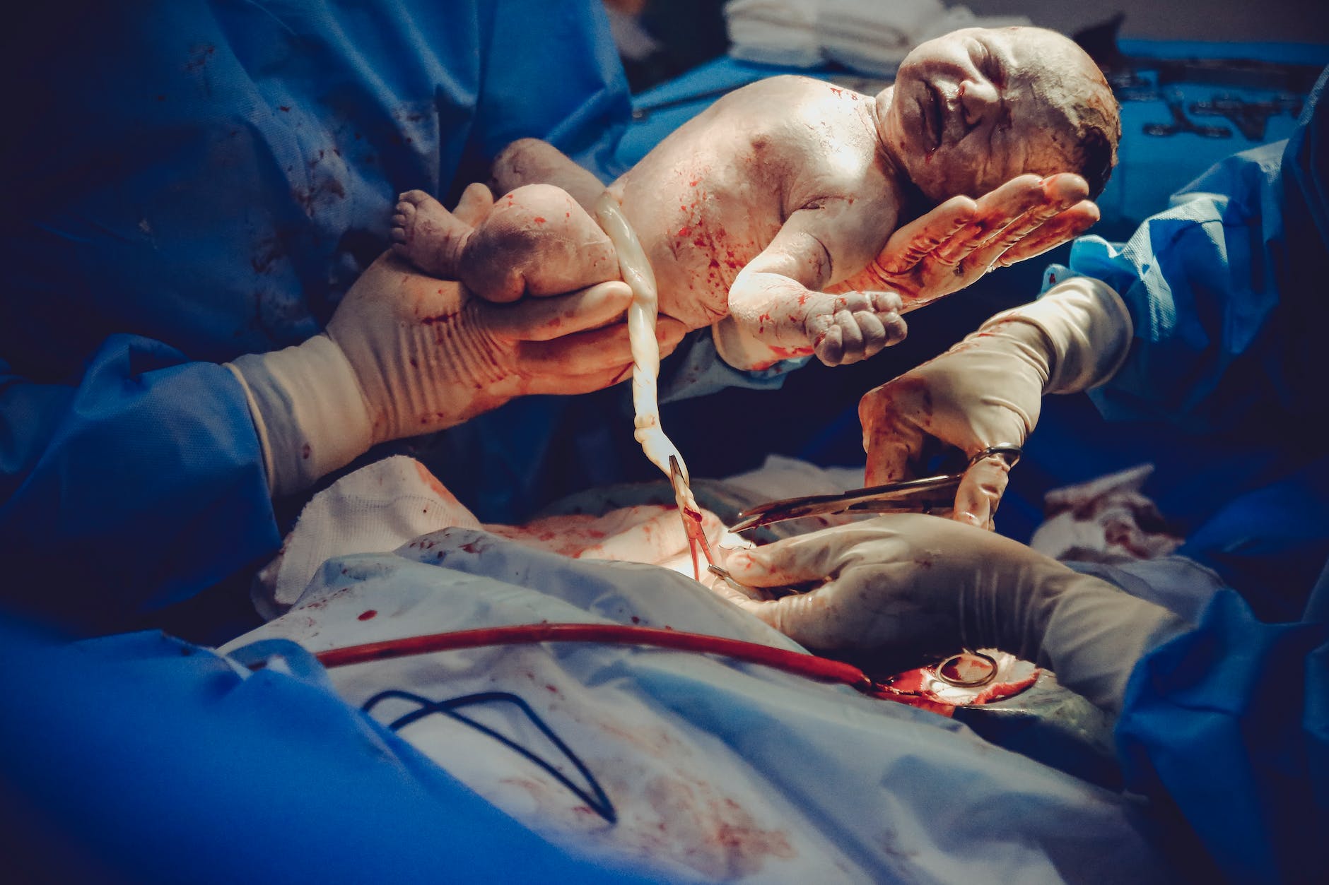 Tip – birth